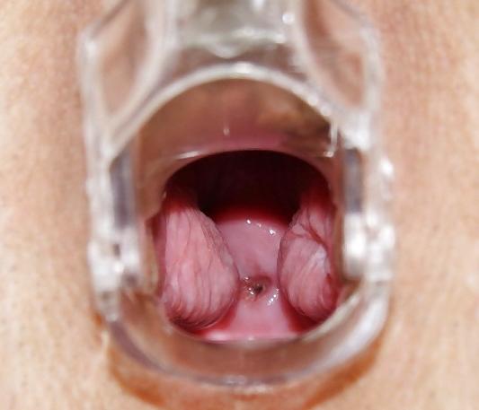 25P Speculum View in a pussy