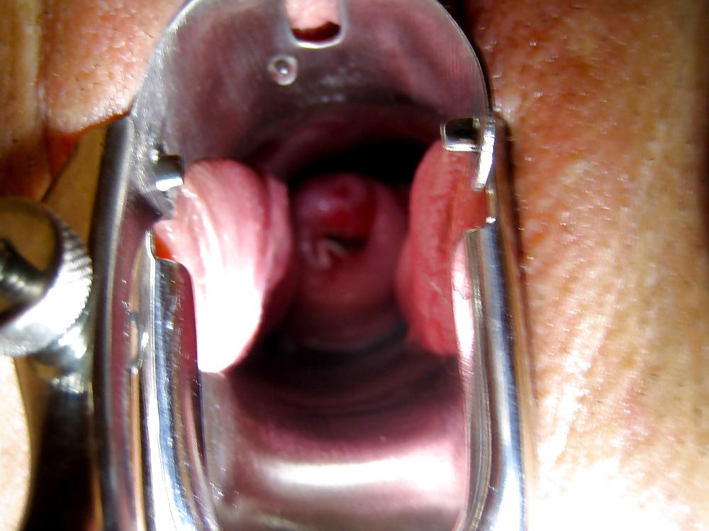 20P MY SPECULUM PICS!!