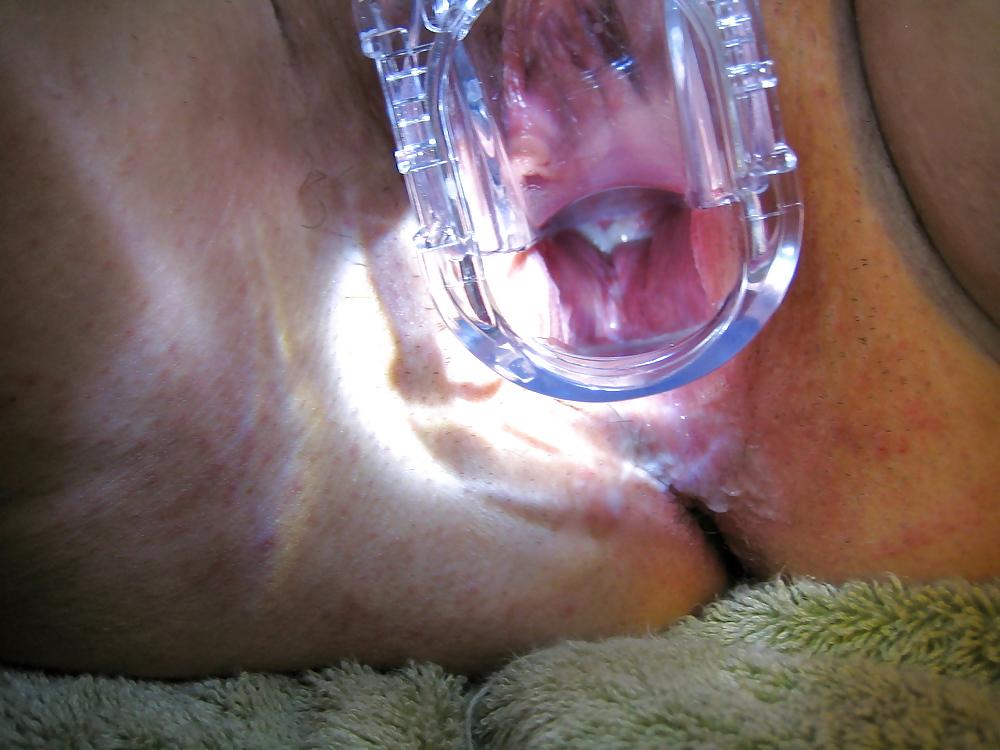 20P MY SPECULUM PICS!!