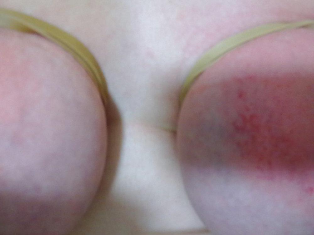 22P Tits punished