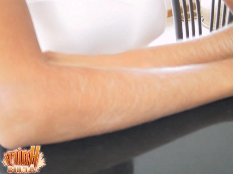 13P Hairy Arms close up