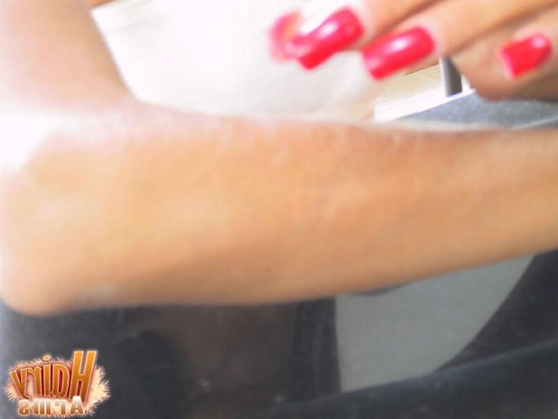 13P Hairy Arms close up