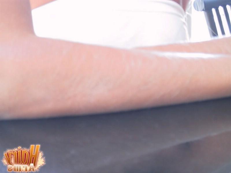 13P Hairy Arms close up