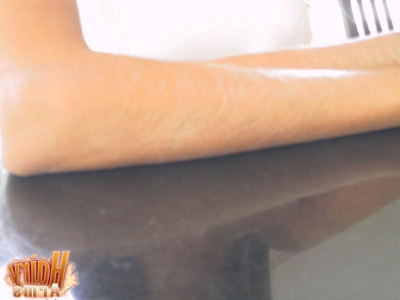 13P Hairy Arms close up
