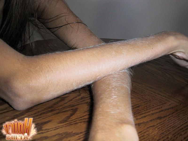 13P Hairy Arms close up