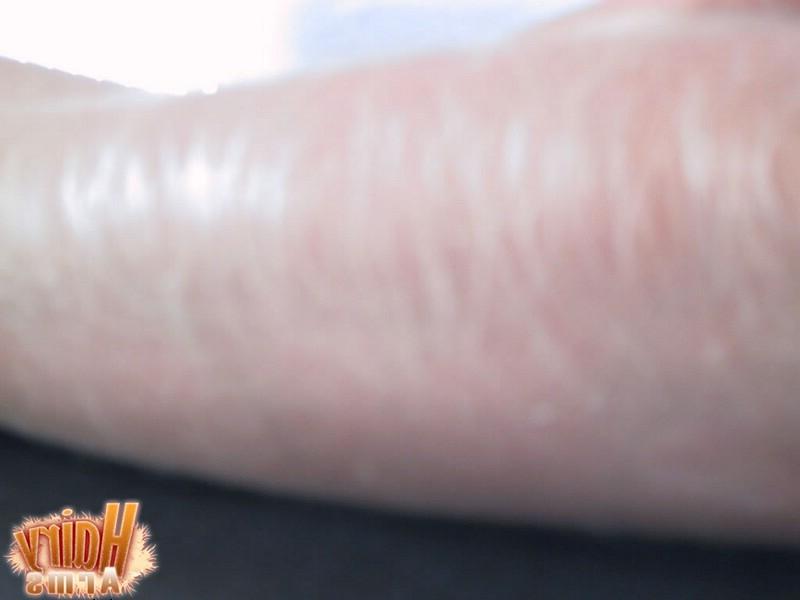 13P Hairy Arms close up