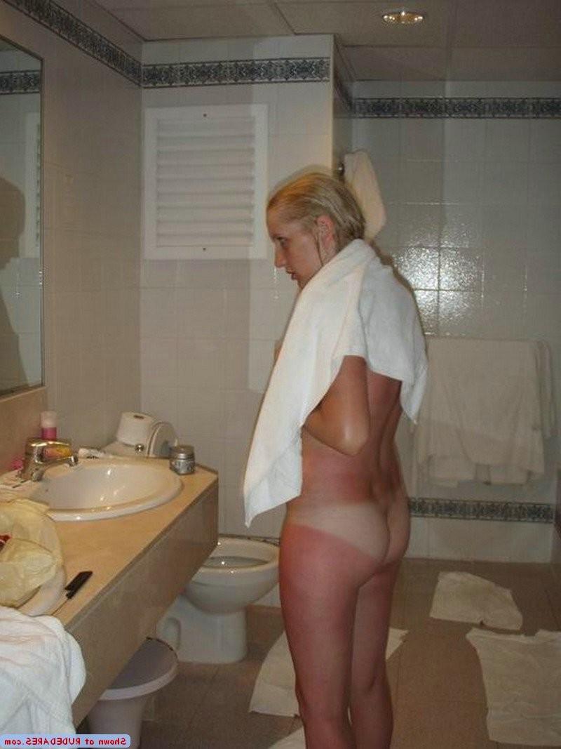 15P Accidental exposure