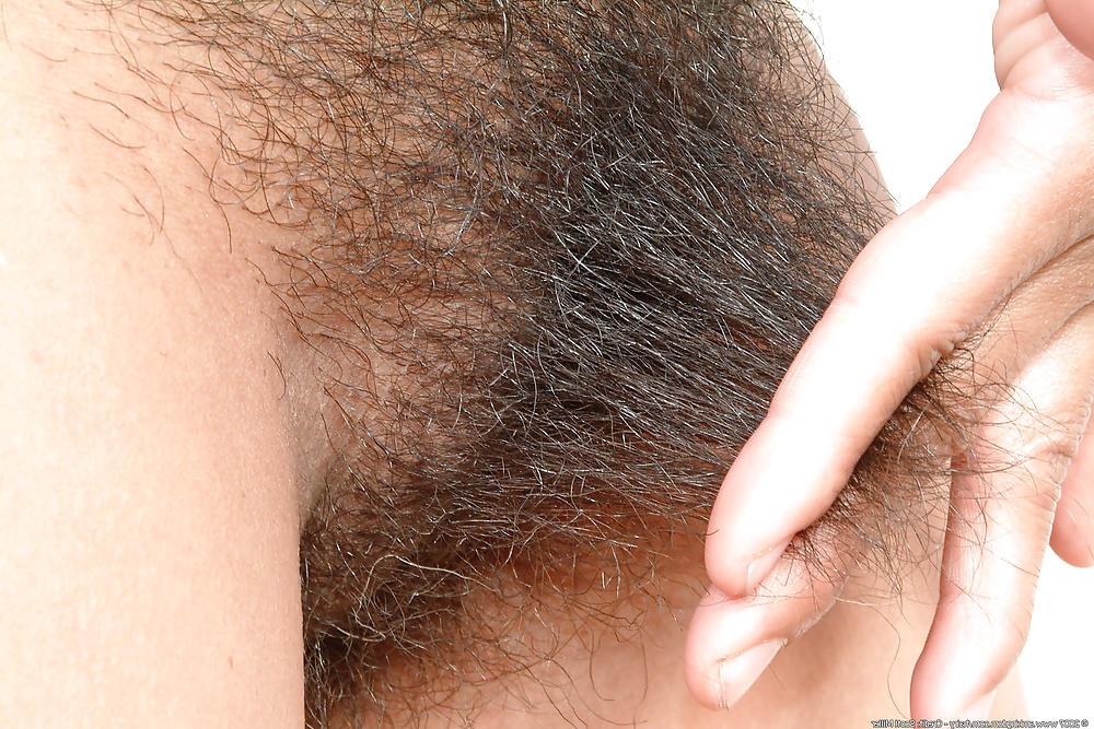 5P Hairy hole