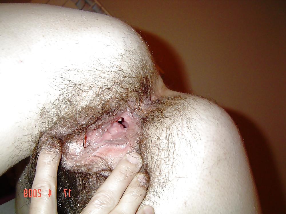 5P Hairy hole