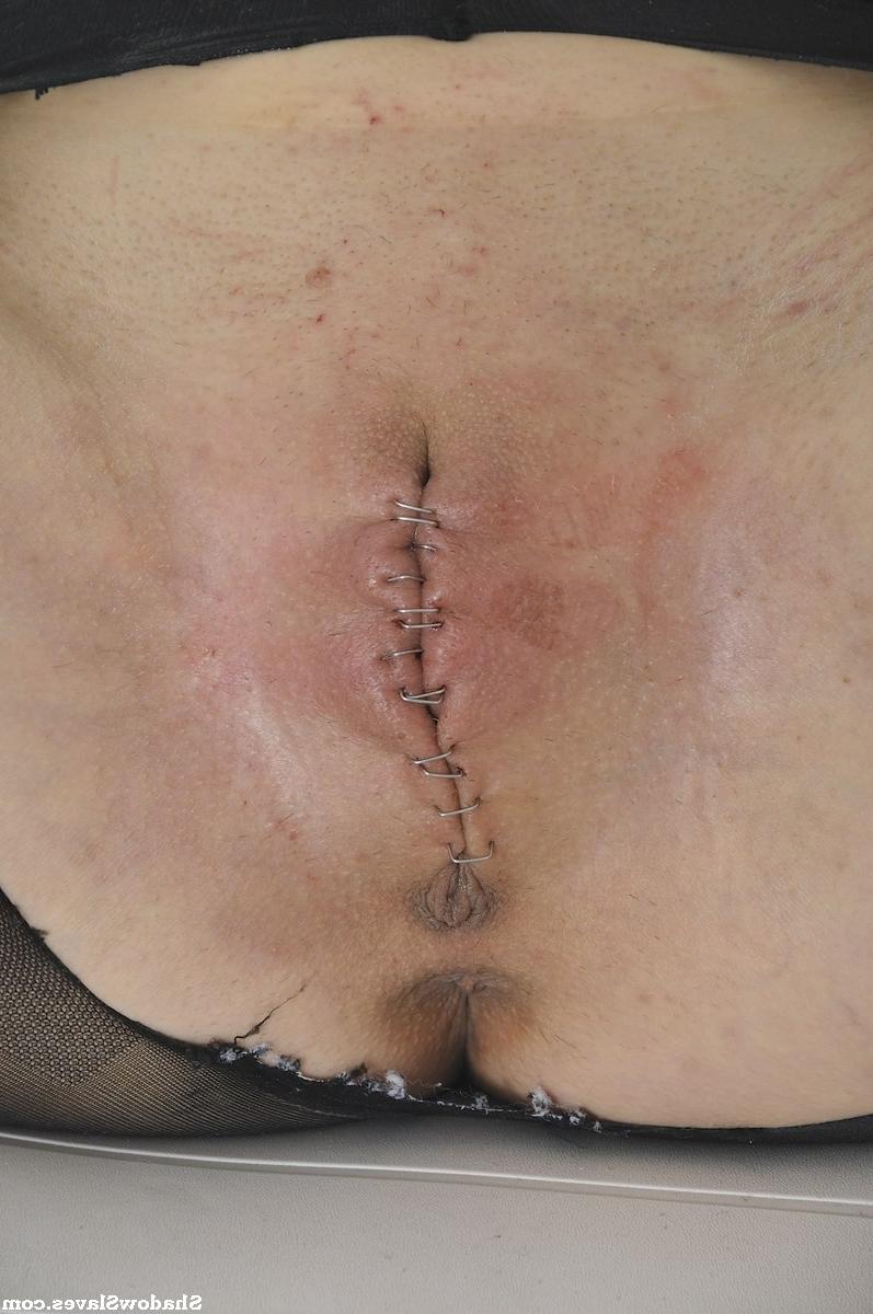 15P Polynese slave Mei Mara in facial needle torture and medical fet