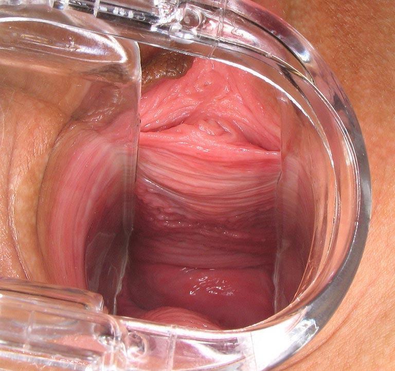 20P brunette does hard speculum games