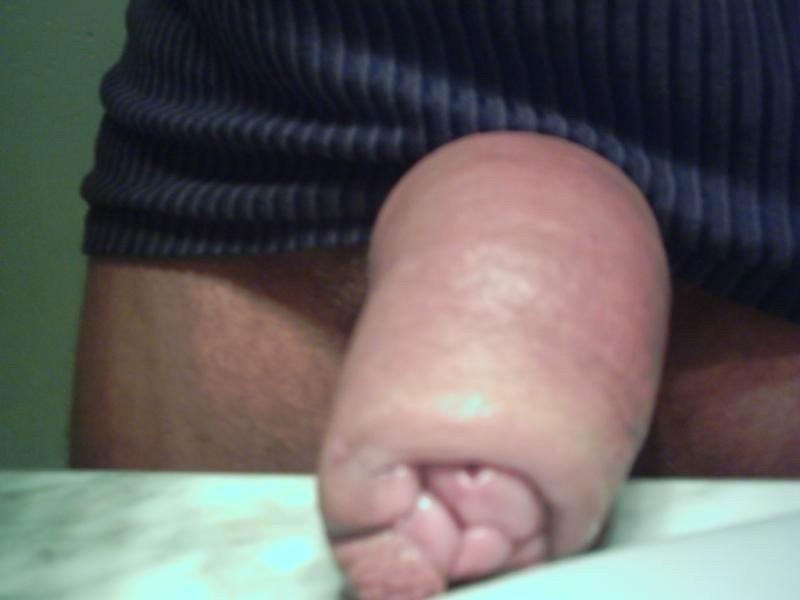 14P Weird cocks