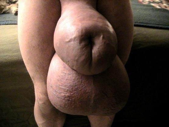 14P Weird cocks