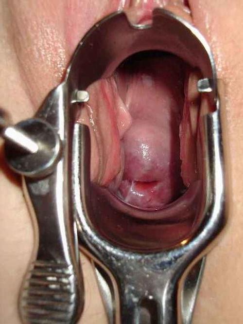 18P extremely speculum playing