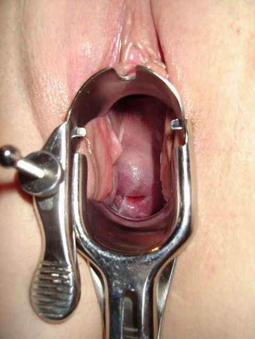 18P extremely speculum playing