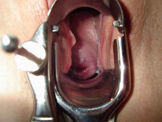 18P extremely speculum playing