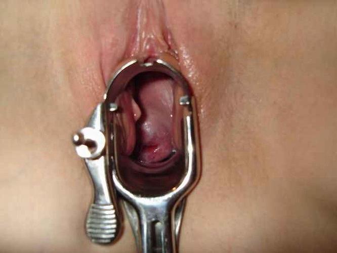 18P extremely speculum playing