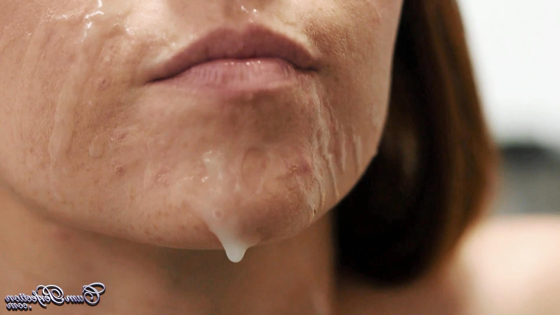 22P Candis escort interview facial