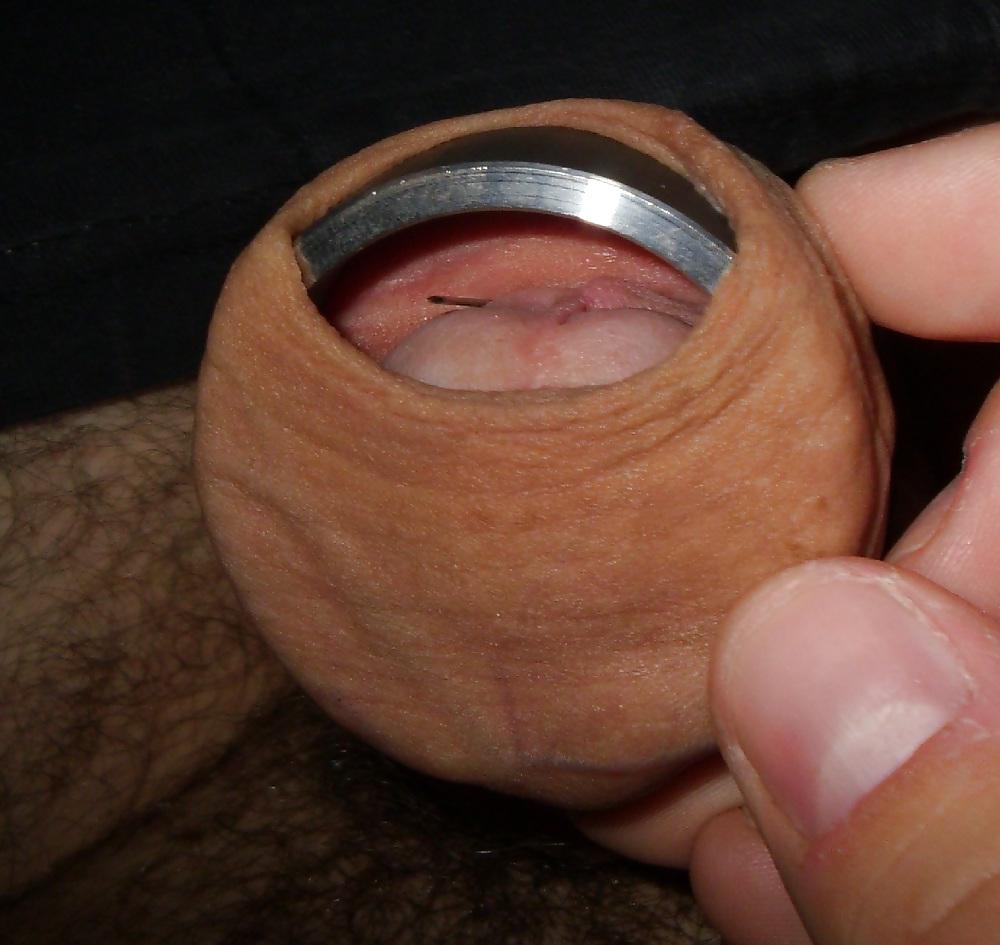 11P Cbt