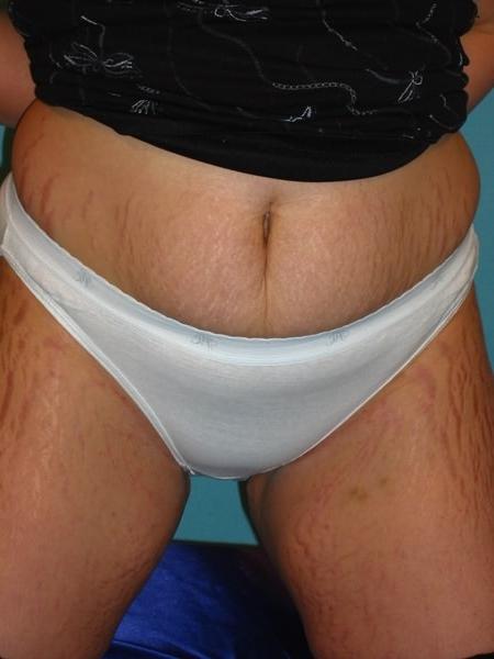 20P Toy fucking fatty