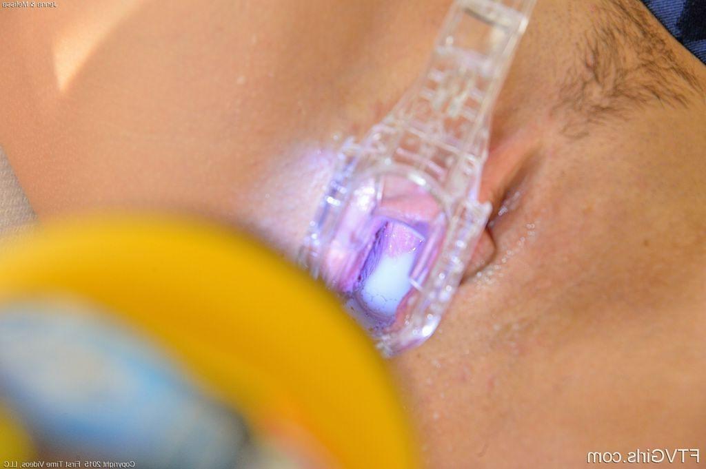 15P Speculum Spreads