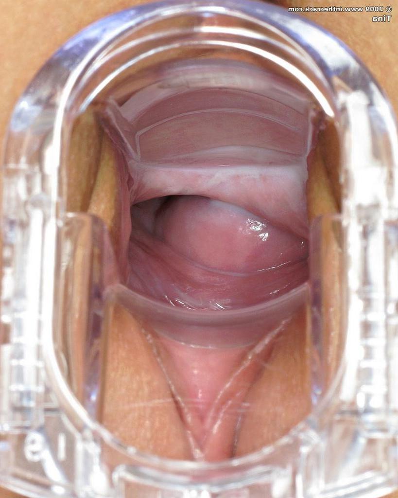 15P Petite teen babe spreads and inserts speculum in her puffy pussy