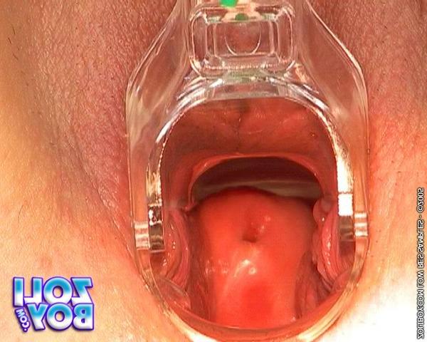 16P Nanette gets fingered and inserts speculum