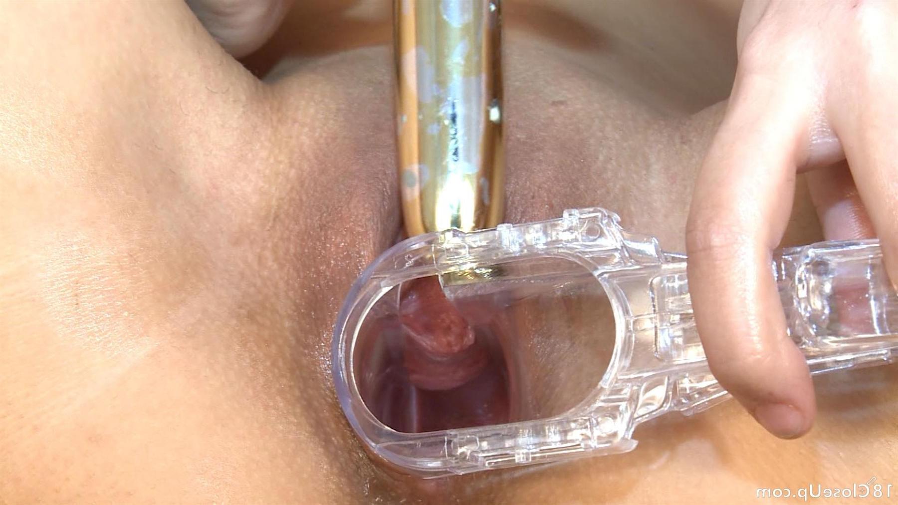 17P Teen plays with a vagina speculum and fingers her gaping pussy