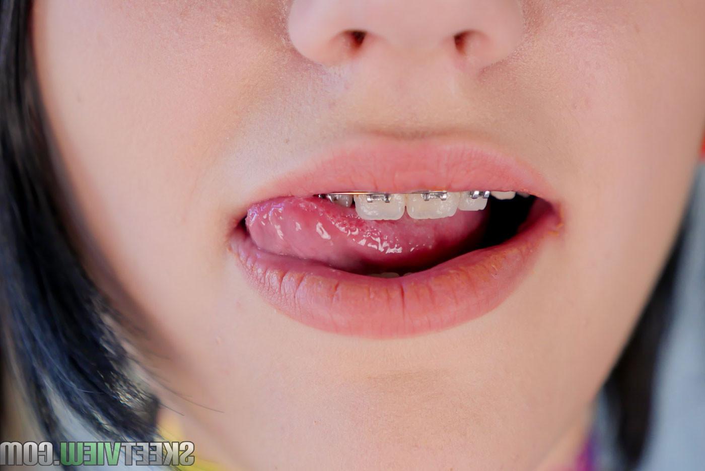 18P Petite Brace Faced Teen Sex