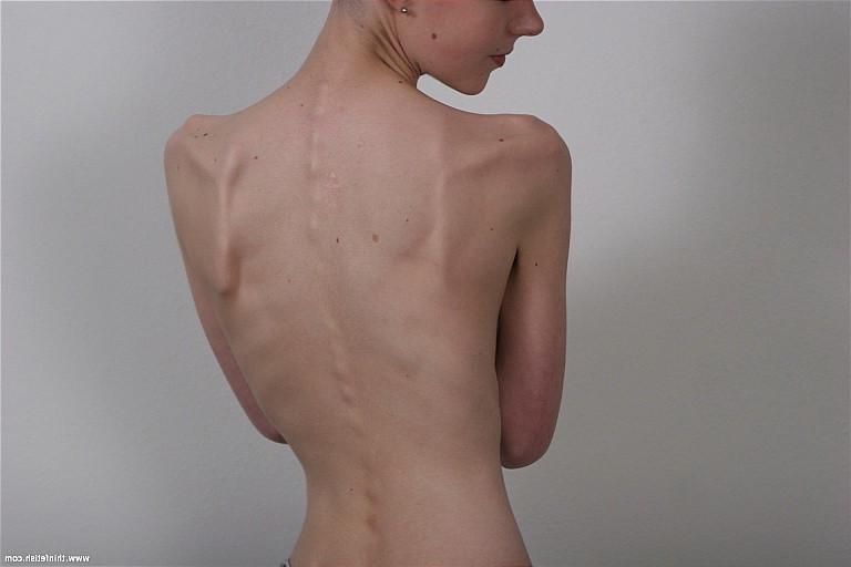 16P Skinny petite bald girl