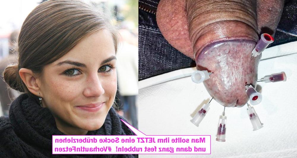 25P German CBT Captions