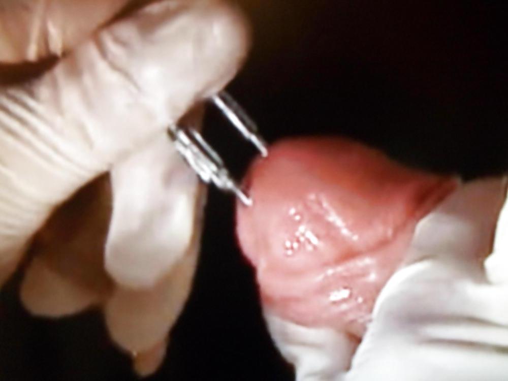 6P TORTURE COCK 