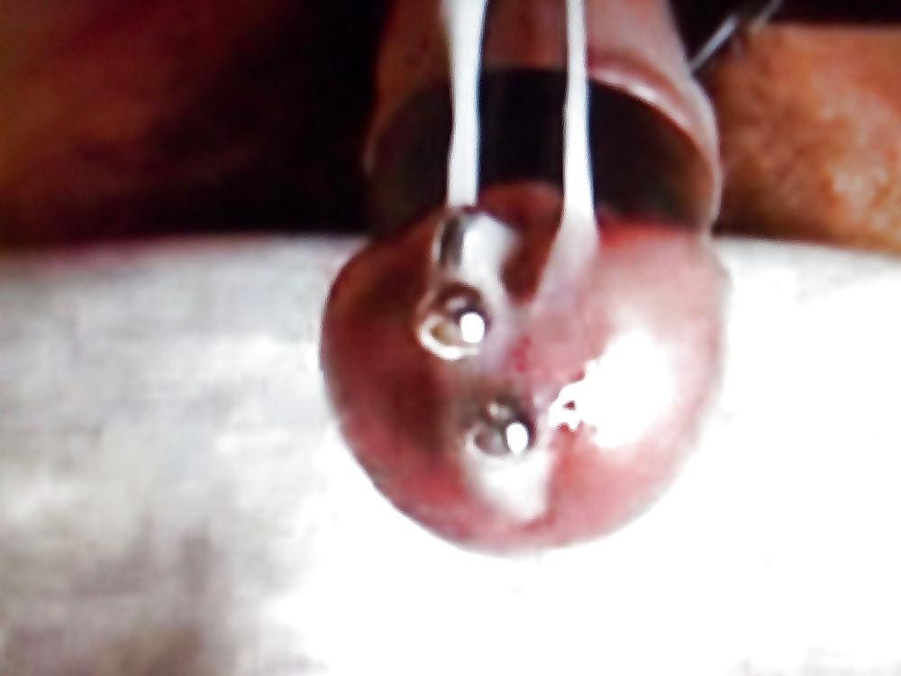 9P SPERMA