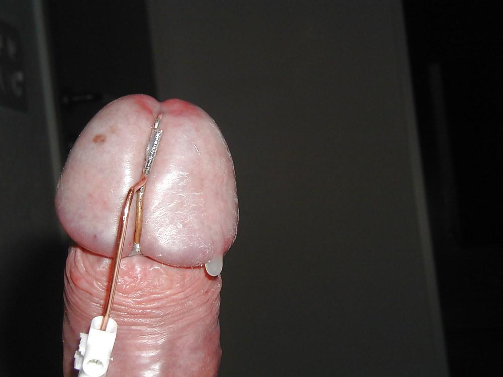 25P My CBT Picture Gallery