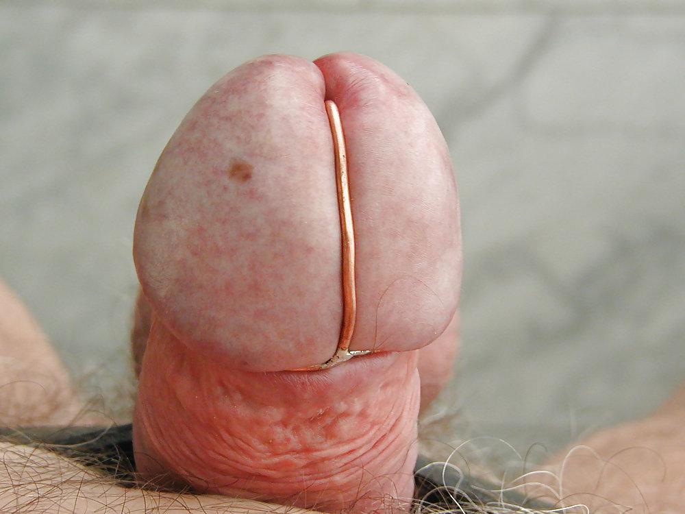 25P My CBT Picture Gallery