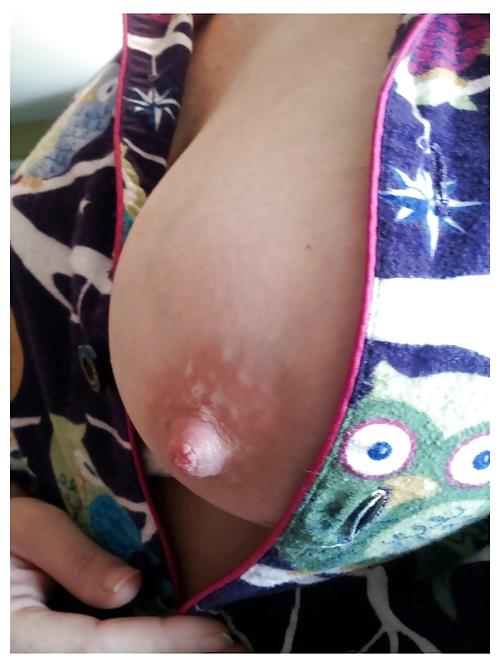 25P Proud Owners Of Perky Big Nipples!!!!!!!!