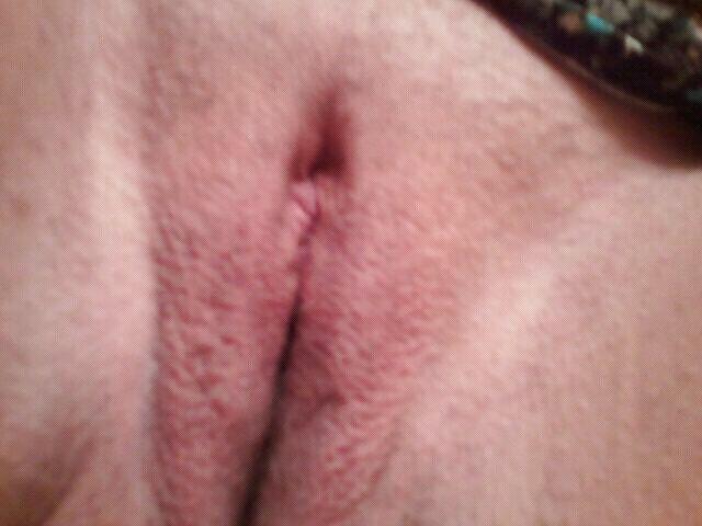 6P Phone Pics