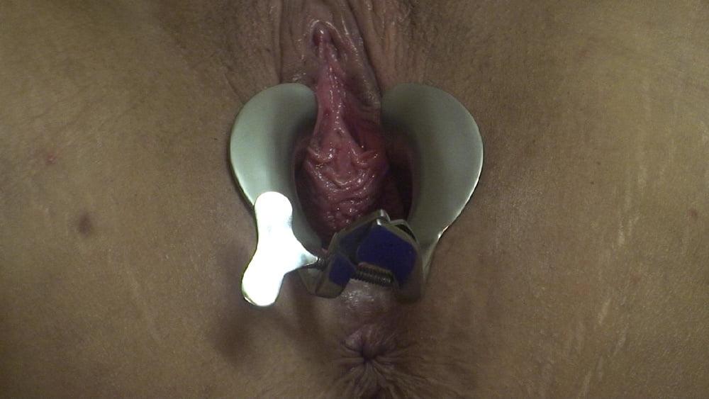 20P "Penalty - Tied and with speculum "