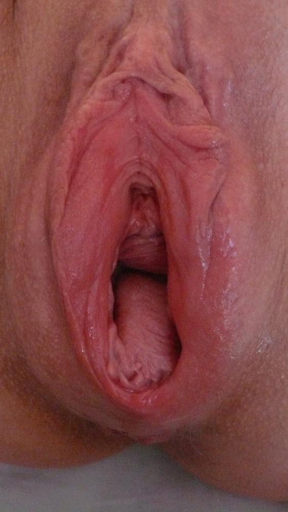 9P my Wife