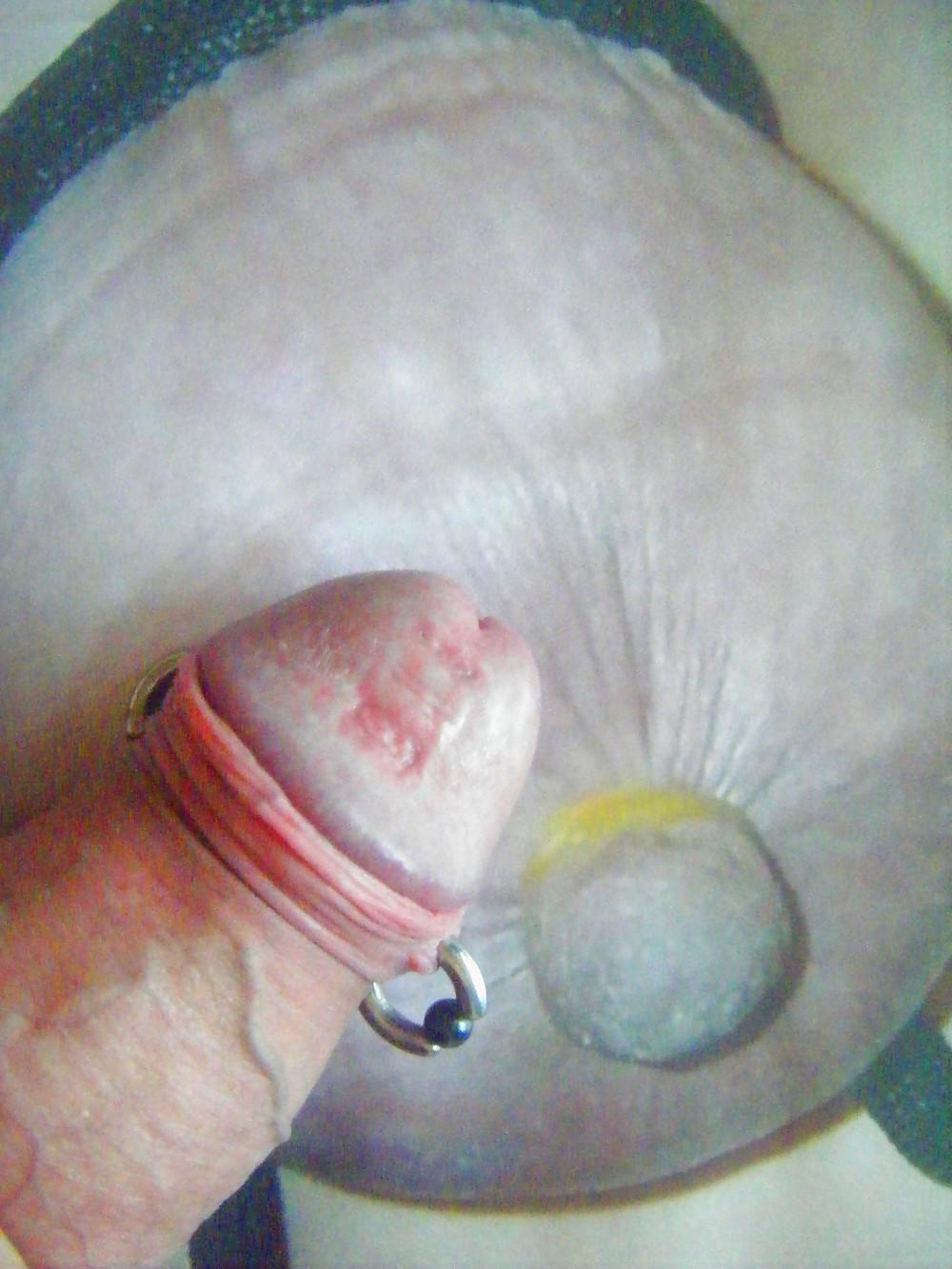 14P CBT with ashtheslut