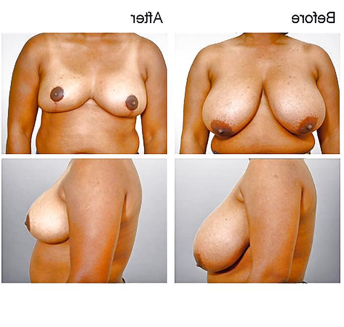 13P What a Shame! (no more HUGE TITS) 