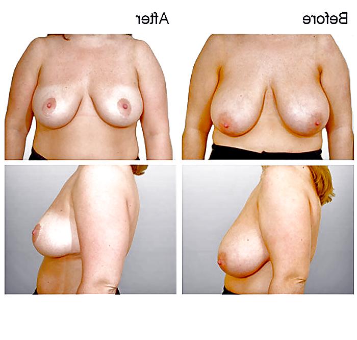 13P What a Shame! (no more HUGE TITS) 