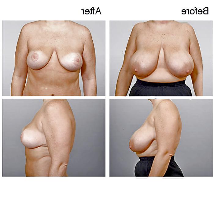 13P What a Shame! (no more HUGE TITS) 