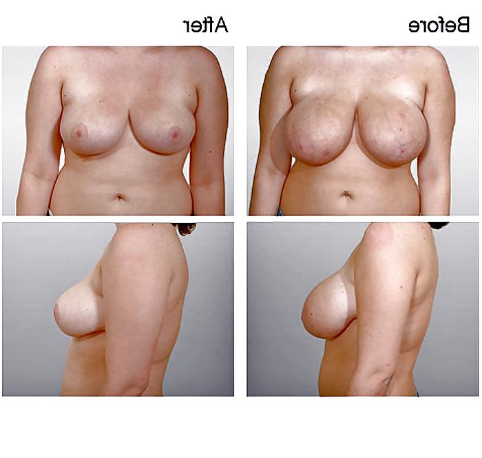13P What a Shame! (no more HUGE TITS) 