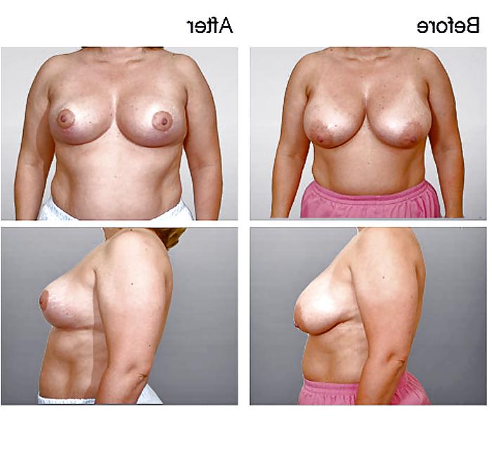 13P What a Shame! (no more HUGE TITS) 