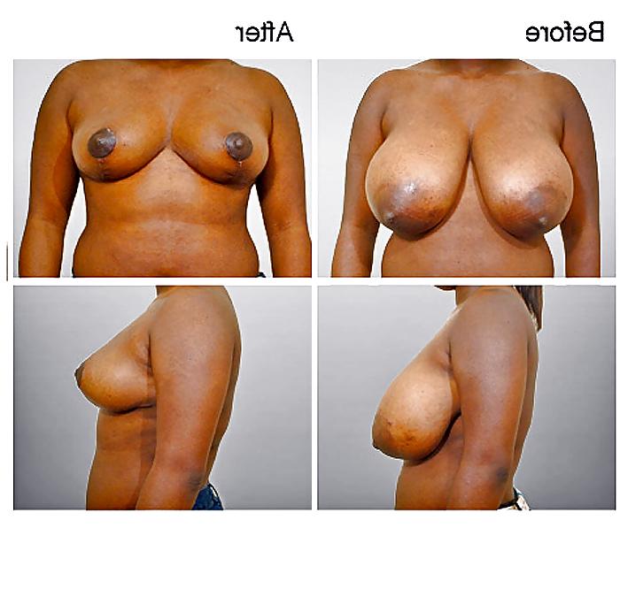 13P What a Shame! (no more HUGE TITS) 