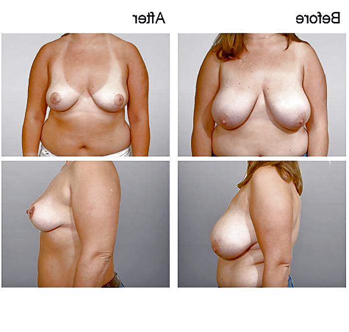 13P What a Shame! (no more HUGE TITS) 