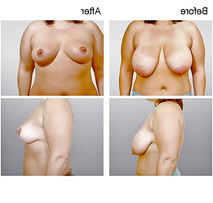 13P What a Shame! (no more HUGE TITS) 