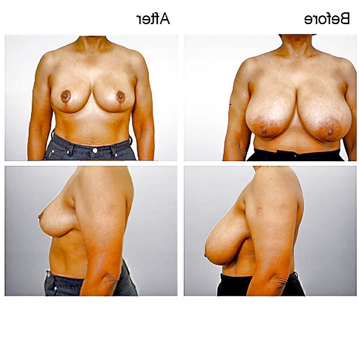 13P What a Shame! (no more HUGE TITS) 