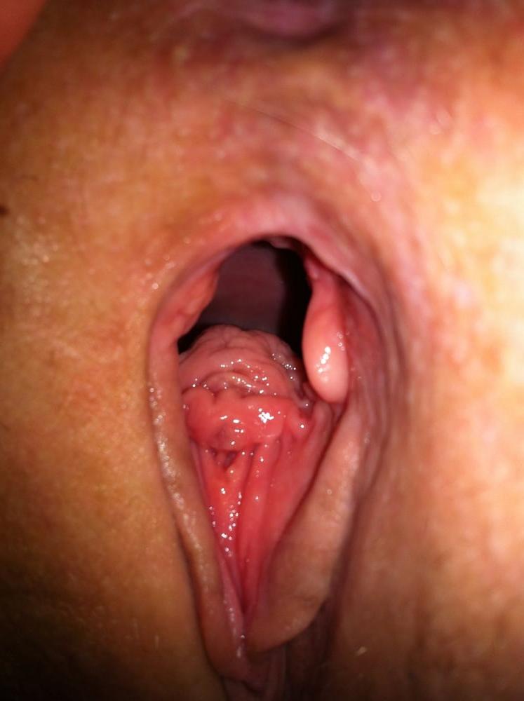 17P My wife 3